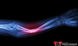 orthopedic injury workers’ comp