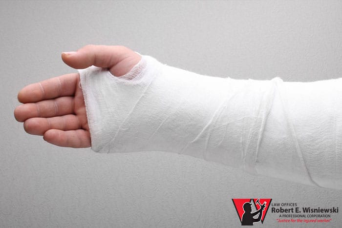 How to get compensation for a broken bone at work in Arizona
